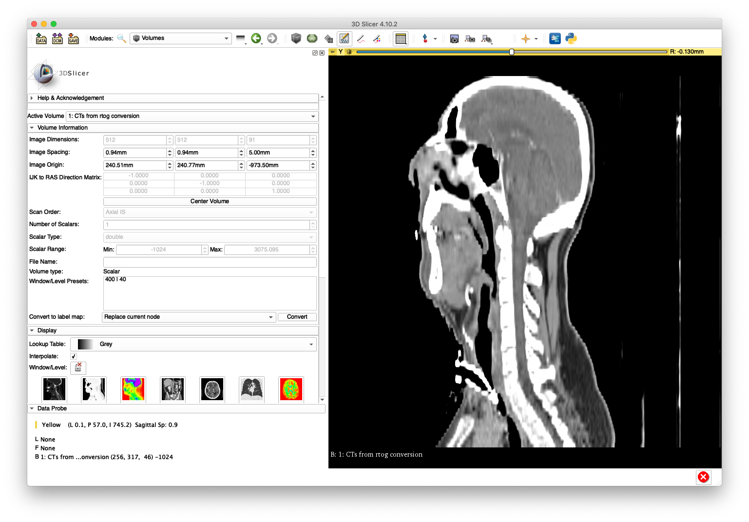 Example 2 Incorrect Sagittal Slice