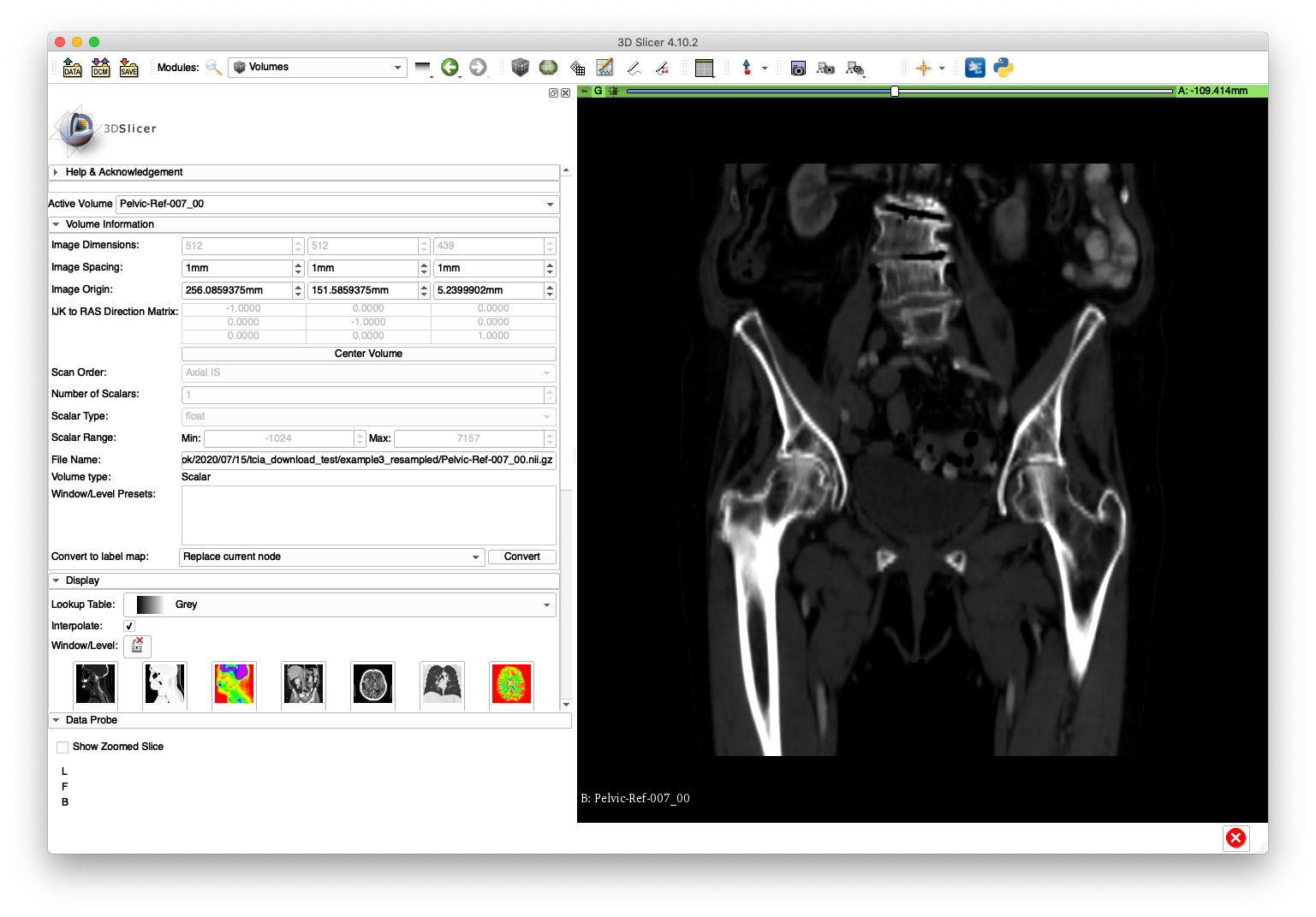 Example 2 Good Sagittal Slice